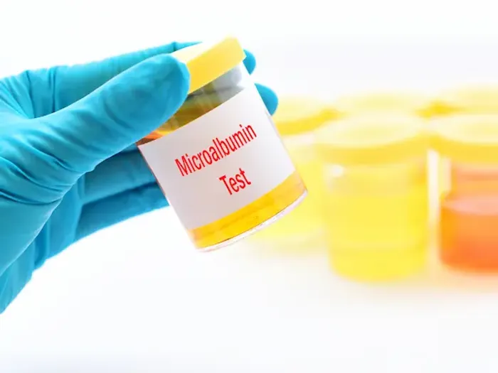 How To Reduce Urine Microalbumin?